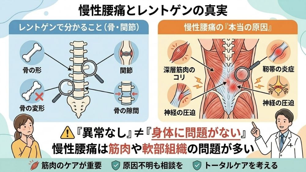 レントゲンでは分からない慢性腰痛を札幌の鍼灸院で改善