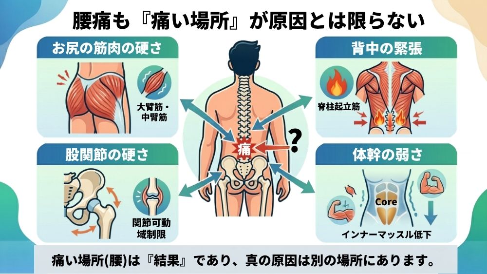 腰痛の本当の原因は痛い所にあるとは限らない