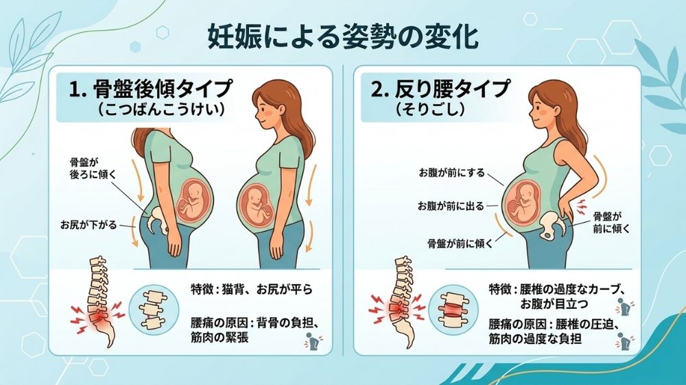妊婦による姿勢の変化