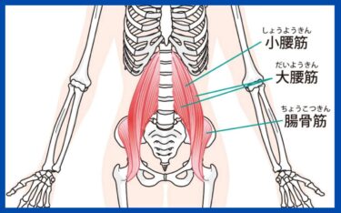腸腰筋のトリガーポイントによる痛みやしびれの原因と対策