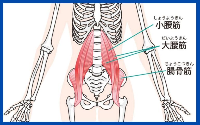 腸腰筋のトリガーポイント鍼灸整体