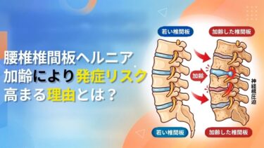 腰椎椎間板ヘルニアが加齢により発症リスクが高まる理由とは？