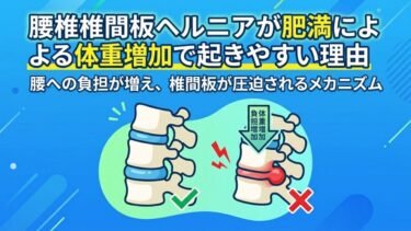 腰椎椎間板ヘルニアが肥満による体重増加で起きやすい理由