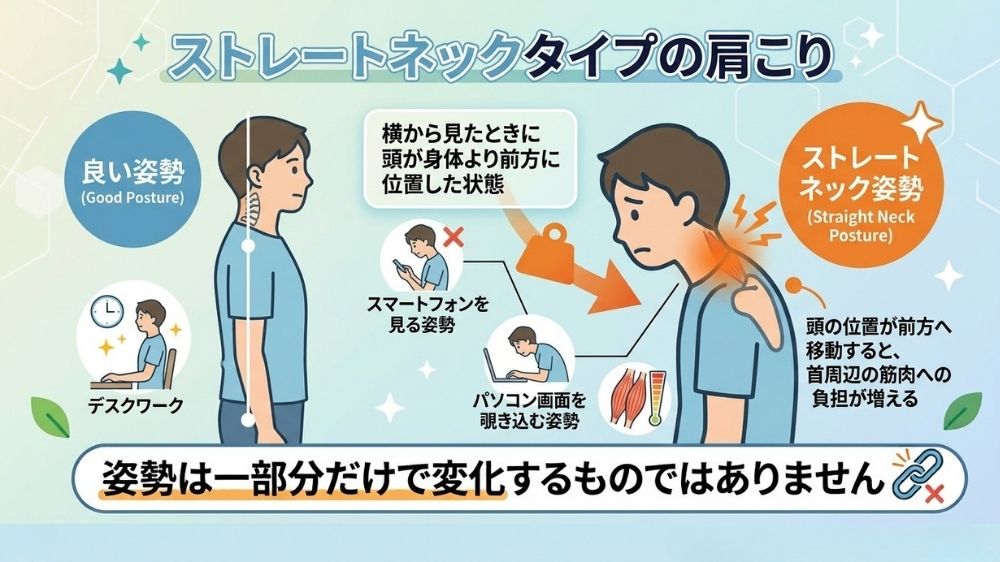 ストレートネックタイプの肩こりを鍼灸整体で改善